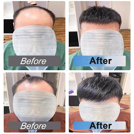 Extensiones de cabello naturales, ligeras y discretas en la parte superior de la cabeza.